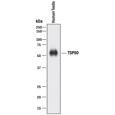 Western Blot TSP50 Antibody [Unconjugated]