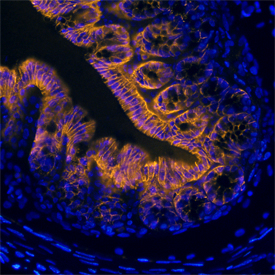 TSPAN8 was detected in perfusion fixed frozen sections of mouse intestine using Rat Anti-Mouse TSPAN8 Monoclonal Antibody (Catalog # MAB6524) at 8 µg/mL overnight at 4 °C. Tissue was stained using the Northern-Lights™ 557-conjugated Anti-Rat IgG Secondary Antibody (yellow; Catalog # NL013) and counterstained with DAPI (blue). Specific staining was localized to membranes of epithelial cells. View our protocol for Fluorescent IHC Staining of Frozen Tissue Sections.