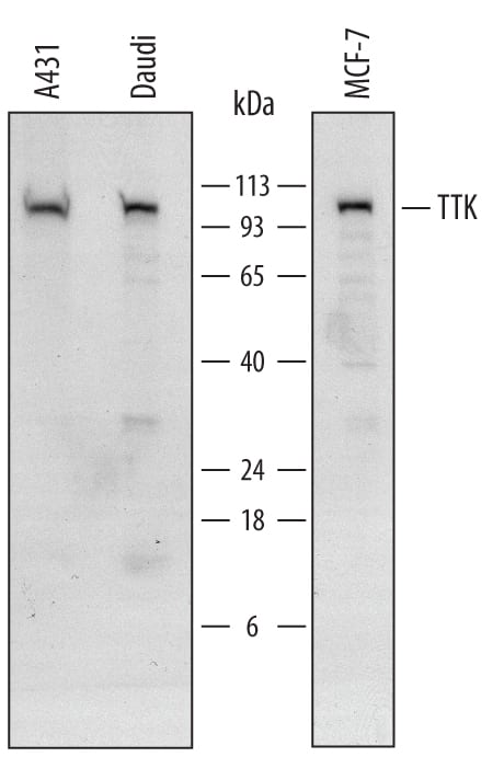 Western blot shows lysates of A431 human epithelial carcinoma cell line, Daudi human Burkitt's lymphoma cell line, and MCF-7 human breast cancer cell line. PVDF Membrane was probed with 0.5 µg/mL of Sheep Anti-Human TTK Antigen Affinity-purified Polyclonal Antibody (Catalog # AF6028) followed by HRP-conjugated Anti-Sheep IgG Secondary Antibody (Catalog # HAF016). A specific band was detected for TTK at approximately 100 kDa (as indicated). This experiment was conducted under reducing conditions and using Immunoblot Buffer Group 1.