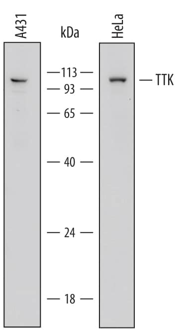 Western Blot TTK Antibody (689913)