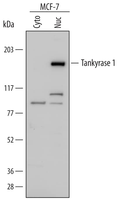 Western Blot Tankyrase 1 Antibody