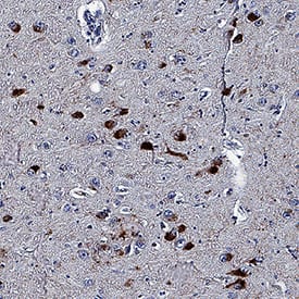 Tau phosphorylated at T231 was detected in immersion fixed paraffin-embedded sections of human Alzheimer's brain using Mouse Anti-Phospho-Tau (T231) Monoclonal Antibody (Catalog # MAB34941) at 5 µg/mL for 1 hour at room temperature followed by incubation with the Anti-Mouse IgG VisUCyte™ HRP Polymer Antibody (Catalog # VC001). Tissue was stained using DAB (brown) and counterstained with hematoxylin (blue). Specific staining was localized to cytoplasm in neurons. View our protocol for IHC Staining with VisUCyte HRP Polymer Detection Reagents.