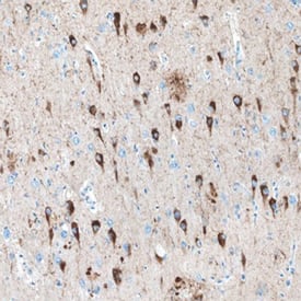Tau was detected in immersion fixed paraffin-embedded sections of human Alzheimer's brain using Mouse Anti-Tau Monoclonal Antibody (Catalog # MAB3494) at 15 µg/mL overnight at 4 °C. Before incubation with the primary antibody, tissue was subjected to heat-induced epitope retrieval using Antigen Retrieval Reagent-Basic (Catalog # CTS013). Tissue was stained using the Anti-Mouse HRP-DAB Cell & Tissue Staining Kit (brown; Catalog # CTS002) and counterstained with hematoxylin (blue). Specific staining was localized to neuronal cell bodies and processes. View our protocol for Chromogenic IHC Staining of Paraffin-embedded Tissue Sections.