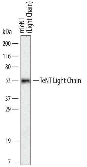 Western blot shows recombinantC. tetaniTeNT Light Chain. PVDF Membrane was probed with 2 µg/mL ofC. tetaniTeNT Light Chain Monoclonal Antibody (Catalog # MAB6535) followed by HRP-conjugated Anti-Mouse IgG Secondary Antibody (Catalog # HAF007). A specific band was detected for TeNT Light Chain at approximately 53 kDa (as indicated). This experiment was conducted under reducing conditions and using Immunoblot Buffer Group 1.