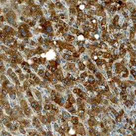 Immunohistochemistry Tec Antibody (663921)