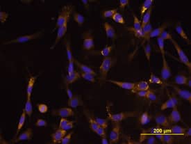 Tenascin C was detected in immersion fixed U-118 MG human glioblastoma/astrocytoma cell line using Rat Anti-Human/Mouse Tenascin C Monoclonal Antibody (Catalog # MAB2138) at 10 µg/mL for 3 hours at room temperature. Cells were stained using the NorthernLights™ 557-conjugated Anti-Rat IgG Secondary Antibody (yellow; Catalog # NL013) and counterstained with DAPI (blue). View our protocol for Fluorescent ICC Staining of Cells on Coverslips.