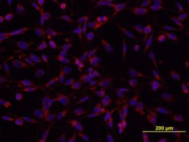 Tenascin C was detected in immersion fixed U‑118‑MG human glioblastoma/astrocytoma cell line using Human Tenascin C Monoclonal Antibody (Catalog # MAB3358) at 10 µg/mL for 3 hours at room temperature. Cells were stained red and counterstained with DAPI (blue).
