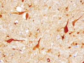 Immunohistochemistry Tenascin R Antibody