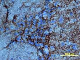 Immunohistochemistry Tenascin R Antibody (619) [Unconjugated]