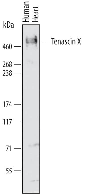 Western Blot Tenascin X Antibody [Unconjugated]