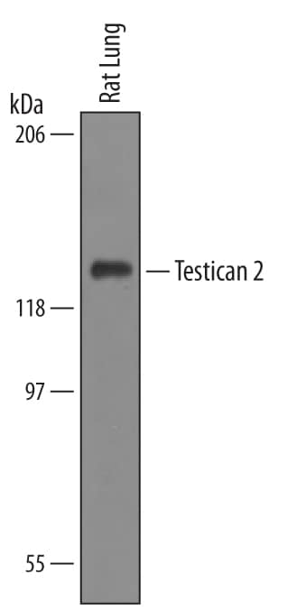 Western Blot Testican 2/SPOCK2 Antibody