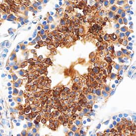Immunohistochemistry Testisin/Prss21 Antibody