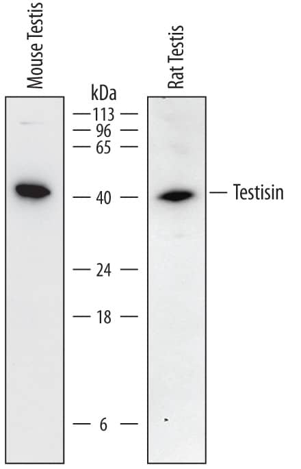 Western Blot Testisin/Prss21 Antibody