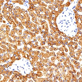 TfR2 was detected in immersion fixed paraffin-embedded sections of human liver using Mouse Anti-Human TfR2 Monoclonal Antibody (Catalog # MAB31201) at 5 µg/mL for 1 hour at room temperature followed by incubation with the Anti-Mouse IgG VisUCyte™ HRP Polymer Antibody (Catalog # VC001). Before incubation with the primary antibody, tissue was subjected to heat-induced epitope retrieval using Antigen Retrieval Reagent-Basic (Catalog # CTS013). Tissue was stained using DAB (brown) and counterstained with hematoxylin (blue). Specific staining was localized to cytoplasm in hepatocytes. View our protocol for IHC Staining with VisUCyte HRP Polymer Detection Reagents.