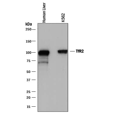 Western Blot TfR2 Antibody (353816) [Unconjugated]