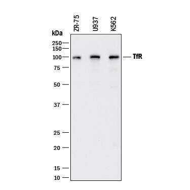 Western Blot TfR (Transferrin R) Antibody [Unconjugated]