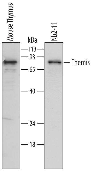 Western Blot Themis Antibody
