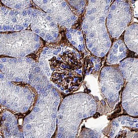Immunohistochemistry Thrombomodulin/BDCA-3 Antibody [Unconjugated]
