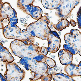 Thrombomodulin/BDCA-3 was detected in immersion fixed paraffin-embedded sections of human placenta using Sheep Anti-Human Thrombomodulin/BDCA-3 Antigen Affinity-purified Polyclonal Antibody (Catalog # AF3947) at 3 µg/mL overnight at 4 °C. Tissue was stained using the Anti-Sheep HRP-DAB Cell & Tissue Staining Kit (brown; Catalog # CTS019) and counterstained with hematoxylin (blue). Specific staining was localized to plasma membranes of syncytiotrophoblasts. View our protocol for Chromogenic IHC Staining of Paraffin-embedded Tissue Sections.