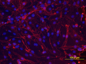 Immunocytochemistry Thrombomodulin/BDCA-3 Antibody (461714)