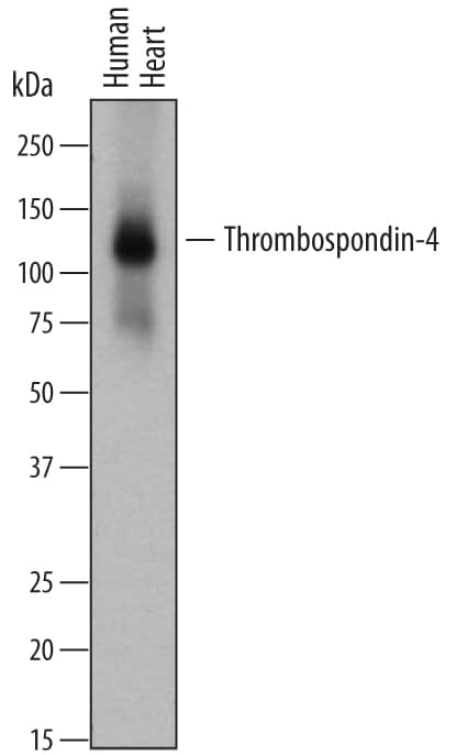 Western Blot Thrombospondin-4 Antibody [Unconjugated]