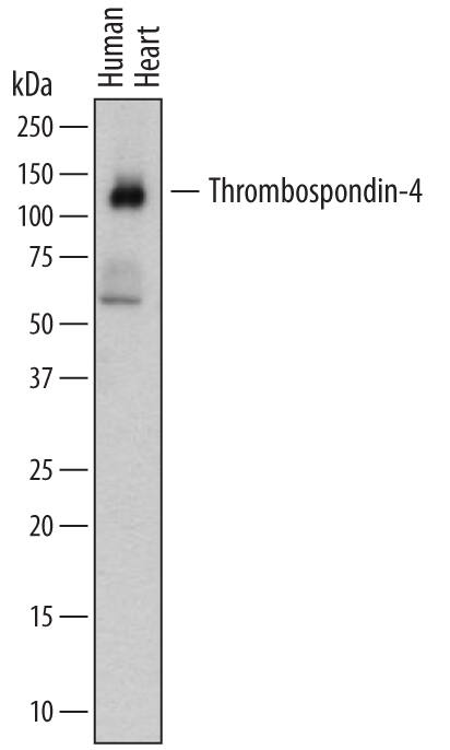 Western Blot Thrombospondin-4 Antibody (276523)