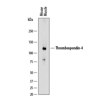 Western Blot Thrombospondin-4 Antibody [Unconjugated]