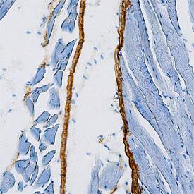 Thrombospondin-4 was detected in perfusion fixed frozen sections of mouse connective tissue using Rat Anti-Mouse Thrombospondin-4 Monoclonal Antibody (Catalog # MAB7860) at 15 µg/mL overnight at 4 °C. Tissue was stained using the Anti-Rat HRP-DAB Cell & Tissue Staining Kit (brown; Catalog # CTS017) and counterstained with hematoxylin (blue). Specific staining was localized to connective tissue. View our protocol for Chromogenic IHC Staining of Frozen Tissue Sections.