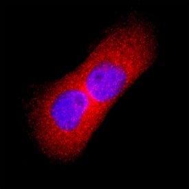 Thymidine Kinase 1 was detected in immersion fixed A431 human epithelial carcinoma cell line using Mouse Anti-Human Thymidine Kinase 1 Monoclonal Antibody (Catalog # MAB8180) at 8 µg/mL for 3 hours at room temperature. Cells were stained using the NorthernLights™ 557-conjugated Anti-Mouse IgG Secondary Antibody (red; Catalog # NL007) and counterstained with DAPI (blue). Specific staining was localized to cytoplasm. View our protocol for Fluorescent ICC Staining of Cells on Coverslips.