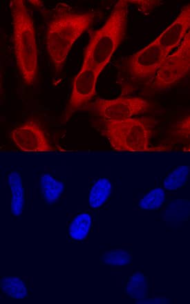 Immunocytochemistry Thymosin beta 4 Antibody [Unconjugated]