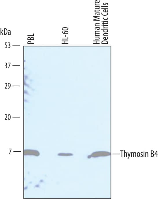Western Blot Thymosin beta 4 Antibody [Unconjugated]