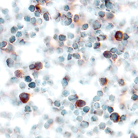 CXCL7/Thymus Chemokine-1 was detected in perfusion fixed frozen sections of mouse thymus using Goat Anti-Mouse CXCL7/Thymus Chemokine-1 Antigen Affinity-purified Polyclonal Antibody (Catalog # AF793) at 5 µg/mL overnight at 4 °C. Tissue was stained using the Anti-Goat HRP-DAB Cell & Tissue Staining Kit (brown; Catalog # CTS008) and counterstained with hematoxylin (blue). Specific labeling was localized to the cytoplasm of lymphocytes. View our protocol for Chromogenic IHC Staining of Frozen Tissue Sections.