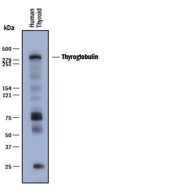 Western blot shows lysates of human thyroid tissue. PVDF membrane was probed with 1 µg/mL of Mouse Anti-Human Thyroglobulin Monoclonal Antibody (Catalog # MAB8306) followed by HRP-conjugated Anti-Mouse IgG Secondary Antibody (Catalog # HAF018). A specific band was detected for Thyroglobulin at approximately 300 kDa (as indicated). This experiment was conducted under reducing conditions and using Immunoblot Buffer Group 1.
