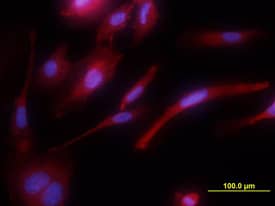 Tie-1 was detected in immersion fixed HUVEC human umbilical vein endothelial cells using Mouse Anti-Human Tie-1 Monoclonal Antibody (Catalog # MAB619) at 10 µg/mL for 3 hours at room temperature. Cells were stained using the NorthernLights™ 557-conjugated Anti-Mouse IgG Secondary Antibody (red; Catalog # NL007) and counterstained with DAPI (blue). View our protocol for Fluorescent ICC Staining of Cells on Coverslips.