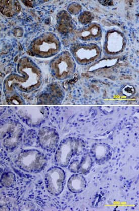 Tie-1 was detected in immersion fixed paraffin-embedded sections of human stomach array using Mouse Anti-Human Tie-1 Monoclonal Antibody (Catalog # MAB619) at 15 µg/mL overnight at 4 °C. Tissue was stained using the Anti-Mouse HRP-DAB Cell & Tissue Staining Kit (brown; Catalog # CTS002) and counterstained with hematoxylin (blue). Lower panel shows a lack of labeling if primary antibodies are omitted and tissue is stained only with secondary antibody followed by incubation with detection reagents. View our protocol for Chromogenic IHC Staining of Paraffin-embedded Tissue Sections.