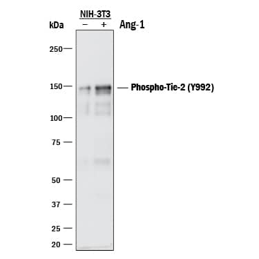 Western blot shows lysates of NIH-3T3 mouse embryonic fibroblast cell line transfected with mouse Tie-2 and untreated (-) or treated (+) with 600 ng/mL Recombinant Human Angiopoietin-1 (Catalog # 923-AN) for 5 minutes. PVDF membrane was probed with 0.5 µg/mL of Rabbit Anti-Human/Mouse Phospho-Tie-2 (Y992) Antigen Affinity-purified Polyclonal Antibody (Catalog # AF2720) followed by HRP-conjugated Anti-Rabbit IgG Secondary Antibody (Catalog # HAF008). A specific band was detected for Phospho-Tie-2 (Y992) at approximately 150 kDa (as indicated). This experiment was conducted under reducing conditions and using Immunoblot Buffer Group 1.