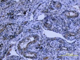 Tie-2 was detected in immersion fixed paraffin-embedded sections of human placenta using Goat Anti-Human Tie-2 Antigen Affinity-purified Polyclonal Antibody (Catalog # AF313) at 10 µg/mL overnight at 4 °C. Tissue was stained using the Anti-Goat HRP-DAB Cell & Tissue Staining Kit (brown; CTS008) and counterstained with hematoxylin (blue). View our protocol for Chromogenic IHC Staining of Paraffin-embedded Tissue Sections.