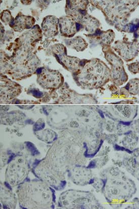 <b>Biological Strategies Validation. </b>Tie-2 phosphorylated at Y1102 was detected in immersion fixed paraffin-embedded sections of human placenta using Rabbit Anti-Human/Mouse Phospho-Tie-2 (Y1102/Y1100) Antigen Affinity-purified Polyclonal Antibody (Catalog # AF3909) at 15 µg/mL overnight at 4 °C. Tissue was stained using the Anti-Rabbit HRP-DAB Cell & Tissue Staining Kit (brown; Catalog # CTS005) and counterstained with hematoxylin (blue). Lower panel shows a lack of labeling if primary antibodies are omitted and tissue is stained only with secondary antibody followed by incubation with detection reagents. View our protocol for Chromogenic IHC Staining of Paraffin-embedded Tissue Sections.