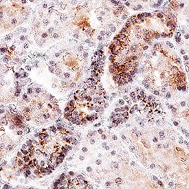 <b>Biological Strategies Validation. </b>Tie-2 was detected in immersion fixed paraffin-embedded sections of human kidney tissue using Rabbit Anti-Human/Mouse Phospho-Tie-2 (Y992) Antigen Affinity-purified Polyclonal Antibody (Catalog # AF2720) at 1 µg/mL overnight at 4 °C. Before incubation with the primary antibody, tissue was subjected to heat-induced epitope retrieval using Antigen Retrieval Reagent-Basic (Catalog # CTS013). Tissue was stained using the Anti-Rabbit IgG VisUCyte™ HRP Polymer Antibody (brown; Catalog # VC003) and counterstained with hematoxylin (blue). Specific staining was localized to cytoplasm in convoluted tubules. View our protocol for IHC Staining with VisUCyte HRP Polymer Detection Reagents.