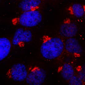 Tissue a-L-Fucosidase/FUCA1 was detected in immersion fixed HeLa human cervical epithelial carcinoma cell line using Sheep Anti-Human Tissue a-L-Fucosidase/FUCA1 Antigen Affinity-purified Polyclonal Antibody (Catalog # AF7039) at 15 µg/mL for 3 hours at room temperature. Cells were stained using the NorthernLights™ 557-conjugated Anti-Sheep IgG Secondary Antibody (red; Catalog # NL010) and counterstained with DAPI (blue). Specific staining was localized to lysosomes. View our protocol for Fluorescent ICC Staining of Cells on Coverslips.