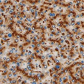Tissue a-L-Fucosidase/FUCA1 was detected in immersion fixed paraffin-embedded sections of human liver using Sheep Anti-Human Tissue a-L-Fucosidase/FUCA1 Antigen Affinity-purified Polyclonal Antibody (Catalog # AF7039) at 5 µg/mL for 1 hour at room temperature followed by incubation with the Anti-Sheep IgG VisUCyte™ HRP Polymer Antibody (Catalog # VC006). Tissue was stained using DAB (brown) and counterstained with hematoxylin (blue). Specific staining was localized to lysosomes in hepatocytes. View our protocol for IHC Staining with VisUCyte HRP Polymer Detection Reagents.