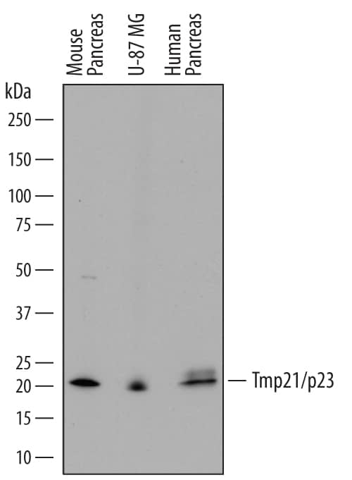 Western blot shows lysates of mouse pancreas tissue, U-87 MG human glioblastoma/astrocytoma cell line, and human pancreas tissue. PVDF membrane was probed with 0.5 µg/mL of Sheep Anti-Human/Mouse Tmp21/p23 Antigen Affinity-purified Polyclonal Antibody (Catalog # AF7630) followed by HRP-conjugated Anti-Sheep IgG Secondary Antibody (Catalog # HAF016). A specific band was detected for Tmp21/p23 at approximately 21 kDa (as indicated). This experiment was conducted under reducing conditions and using Immunoblot Buffer Group 1.