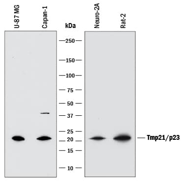 Western blot shows lysates of U-87 MG human glioblastoma/astrocytoma cell line, Capan-1 human pancreatic adenocarcinoma cell line, Neuro-2A mouse neuroblastoma cell line, and Rat-2 rat embryonic fibroblast cell line. PVDF membrane was probed with 1 µg/mL of Mouse Anti-Human/Mouse/Rat Tmp21/p23 Monoclonal Antibody (Catalog # MAB7630) followed by HRP-conjugated Anti-Mouse IgG Secondary Antibody (Catalog # HAF018). A specific band was detected for Tmp21/p23 at approximately 21 kDa (as indicated). This experiment was conducted under reducing conditions and using Immunoblot Buffer Group 1.