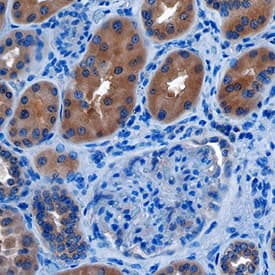 Immunohistochemistry Transcobalamin II Antibody