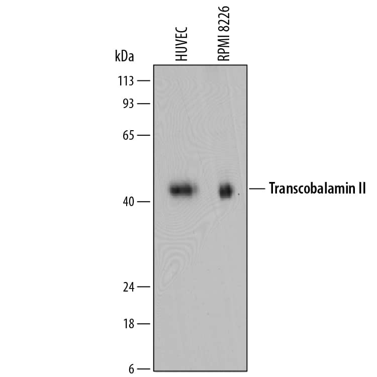 Western Blot Transcobalamin II Antibody