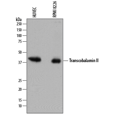 Western Blot Transcobalamin II Antibody (874420) [Unconjugated]