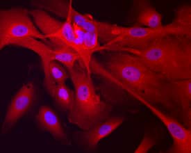 Transgelin/TAGLN was detected in immersion fixed MCF 10A human breast epithelial cell line using Sheep Anti-Human/Mouse/Rat Transgelin/TAGLN Antigen Affinity-purified Polyclonal Antibody (Catalog # AF7886) at 10 µg/mL for 3 hours at room temperature. Cells were stained using the NorthernLights™ 557-conjugated Anti-Sheep IgG Secondary Antibody (red; Catalog # NL010) and counterstained with DAPI (blue). Specific staining was localized to cytoplasm. View our protocol for Fluorescent ICC Staining of Cells on Coverslips.