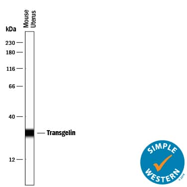 Simple Western lane view shows lysates of mouse uterus tissue, loaded at 0.2 mg/mL. A specific band was detected for Transgelin/TAGLN at approximately 29 kDa (as indicated) using 25 µg/mL of Sheep Anti-Human/Mouse/Rat Transgelin/TAGLN Antigen Affinity-purified Polyclonal Antibody (Catalog # AF7886) followed by 1:50 dilution of HRP-conjugated Anti-Sheep IgG Secondary Antibody (Catalog # HAF016). This experiment was conducted under reducing conditions and using the 12-230 kDa separation system.