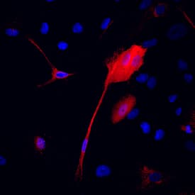 Transgelin/TAGLN was detected in immersion fixed MCF 10A human breast epithelial cell line using Mouse Anti-Human Transgelin/TAGLN Monoclonal Antibody (Catalog # MAB78861) at 10 µg/mL for 3 hours at room temperature. Cells were stained using the NorthernLights™ 557-conjugated Anti-Mouse IgG Secondary Antibody (red; Catalog # NL007) and counterstained with DAPI (blue). Specific staining was localized to cytoplasm. View our protocol for Fluorescent ICC Staining of Cells on Coverslips.
