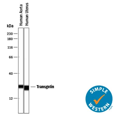 Simple Western lane view shows lysates of human aorta tissue and human uterus tissue, loaded at 0.5 mg/mL. A specific band was detected for Transgelin/TAGLN at approximately 22-25 kDa (as indicated) using 5 µg/mL of Mouse Anti-Human Transgelin/TAGLN Monoclonal Antibody (Catalog # MAB78861). This experiment was conducted under reducing conditions and using the 12-230 kDa separation system.